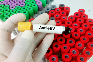 Alt text = imagem relacionada a procura pela cura da AIDS